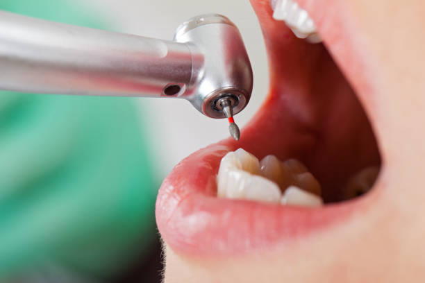 Best Emergency Broken Tooth Repair in Kirtland Af, NM